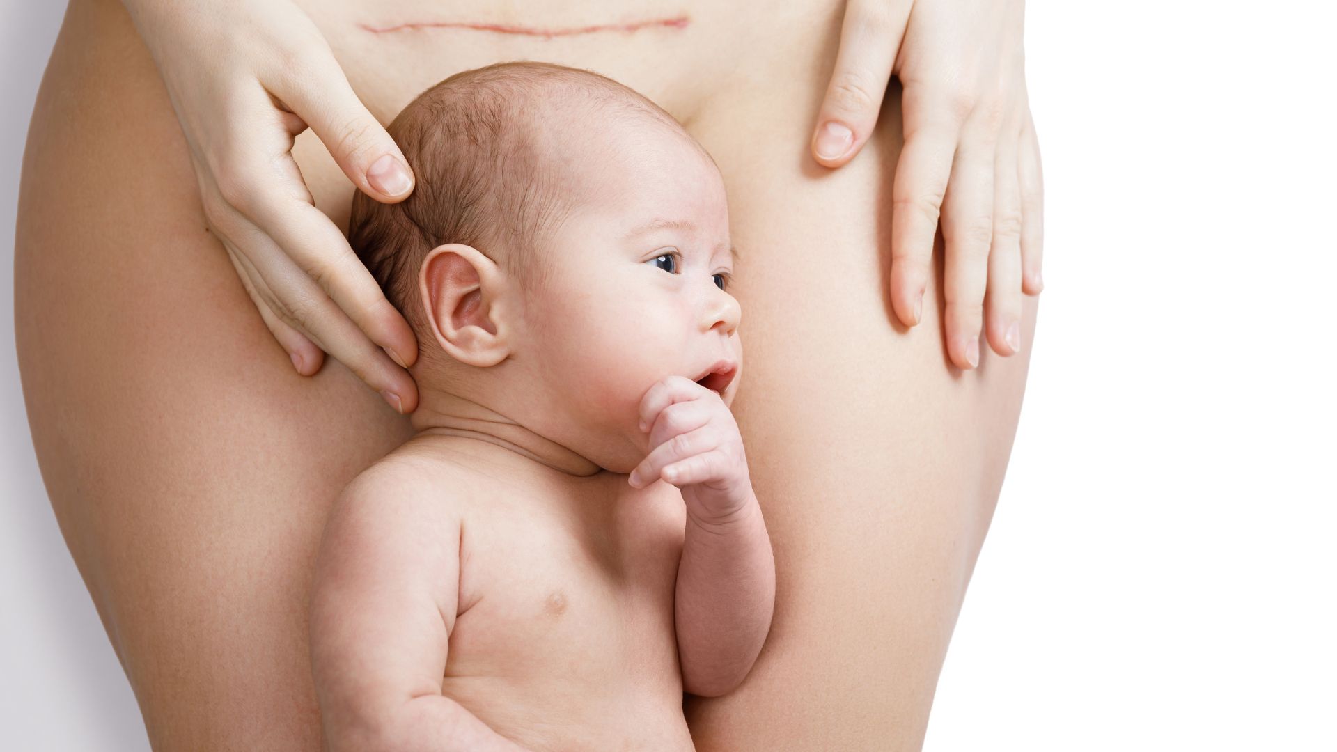 Mẹ sinh mổ lần 3 sẽ phải đối mặt với nhiều rủi ro