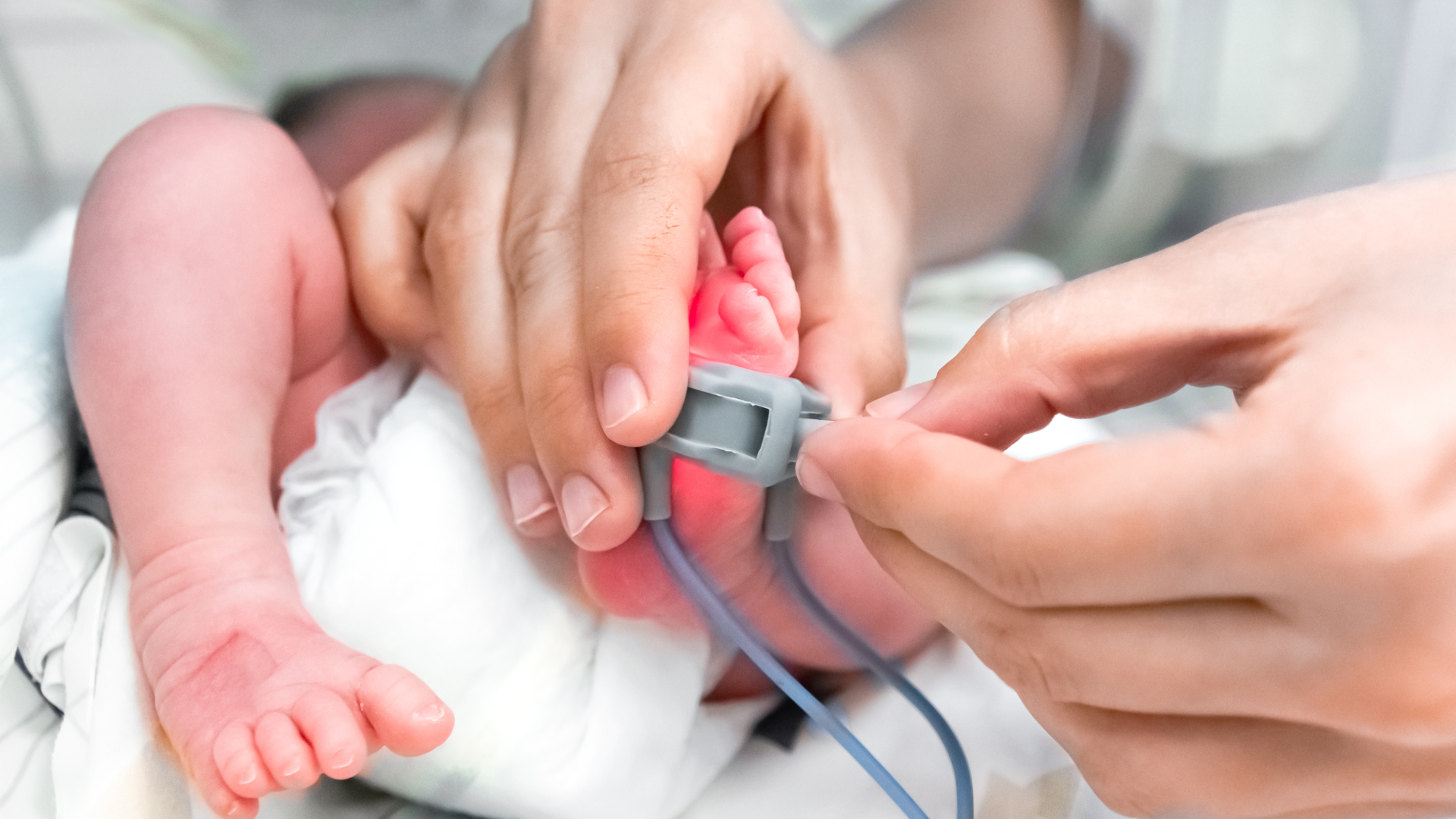 Tỷ lệ sống sót của trẻ sinh ở 28 tuần có thể đạt 80 - 90% nếu được chăm sóc trong khoa hồi sức sơ sinh