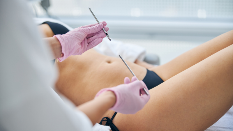 Sinh thiết nội mạc tử cung: Quy trình và những lưu ý quan trọng 3