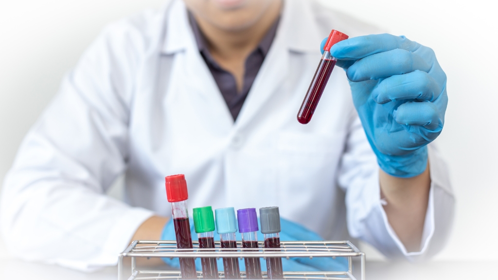 Sinh thiết thận: Quy trình, chỉ định và những điều cần lưu ý 3