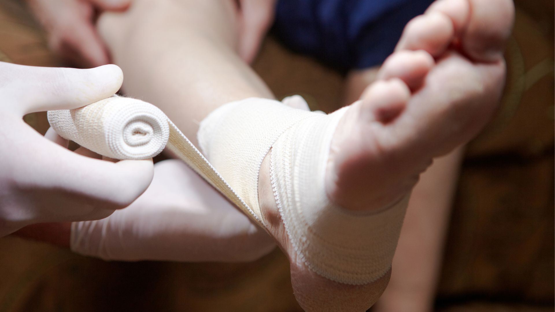 Sơ cứu bong gân đúng cách giúp giảm đau và hạn chế nguy cơ để lại di chứng