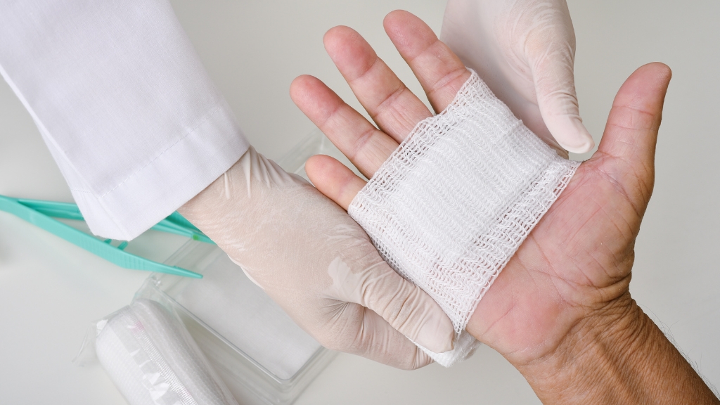Sơ cứu khi bị bỏng: Hướng dẫn chi tiết và chuẩn y khoa để xử trí an toàn 2