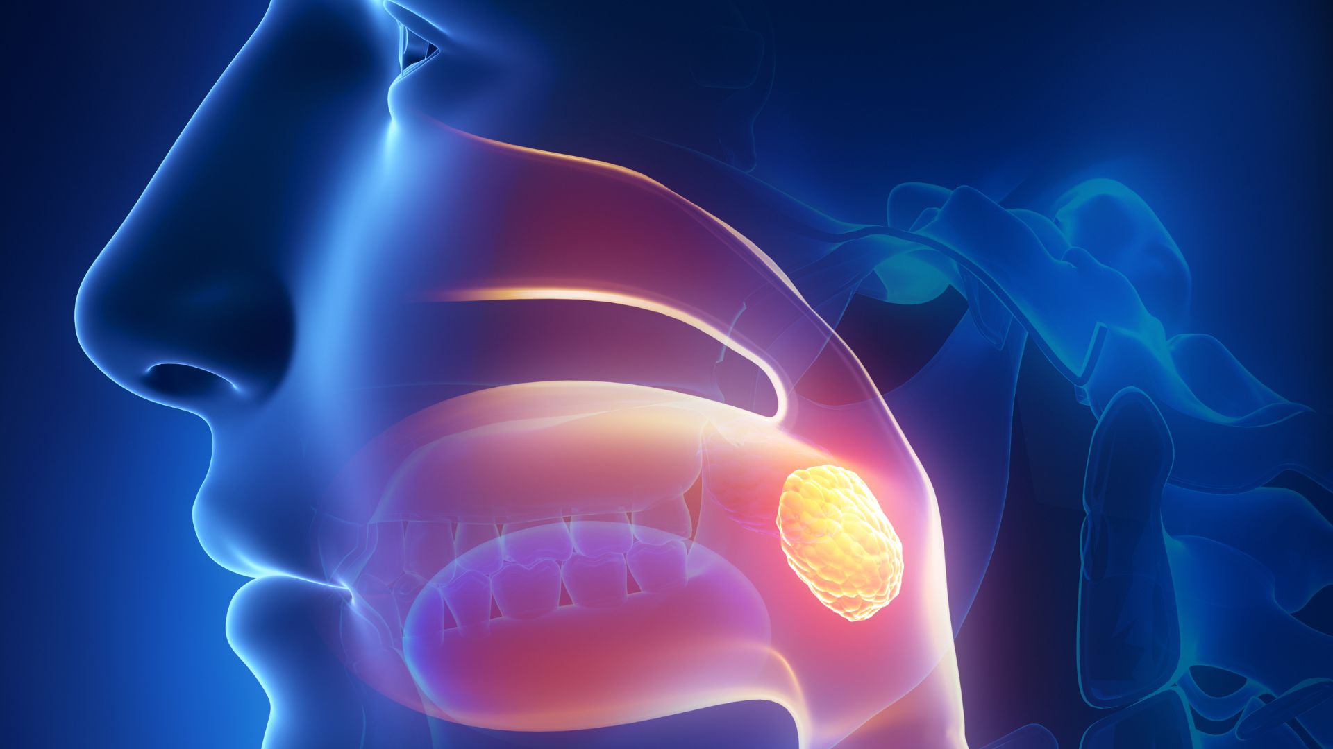 Sỏi amidan: Nguy&ecirc;n nh&acirc;n, triệu chứng v&agrave; c&aacute;ch ph&ograve;ng ngừa - Trung t&acirc;m Ti&ecirc;m  chủng Long Ch&acirc;u