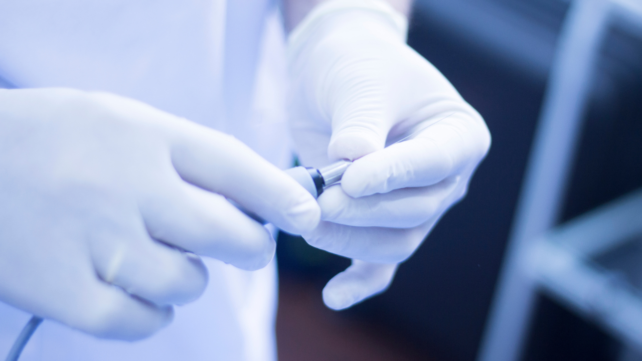 Tán sỏi thận qua da (PCNL) ít gây đau