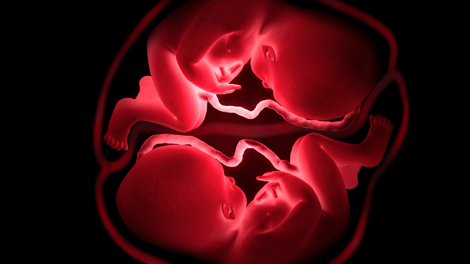 So với song thai 1 nhau, song thai 2 nhau gần như không gặp hội chứng truyền máu song thai hay thai chậm phát triển chọn lọc