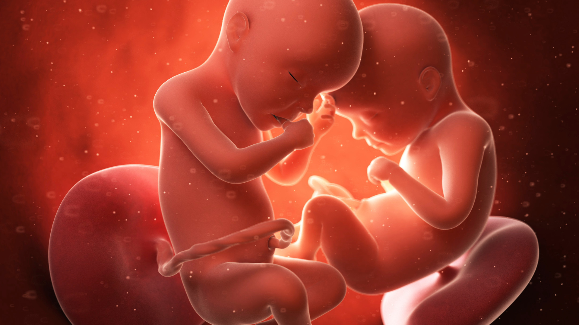 Phần lớn các trường hợp song thai 3 tháng đầu có 1 thai ngừng phát triển xuất phát từ bất thường của chính thai đó, không phải do lỗi của người mẹ