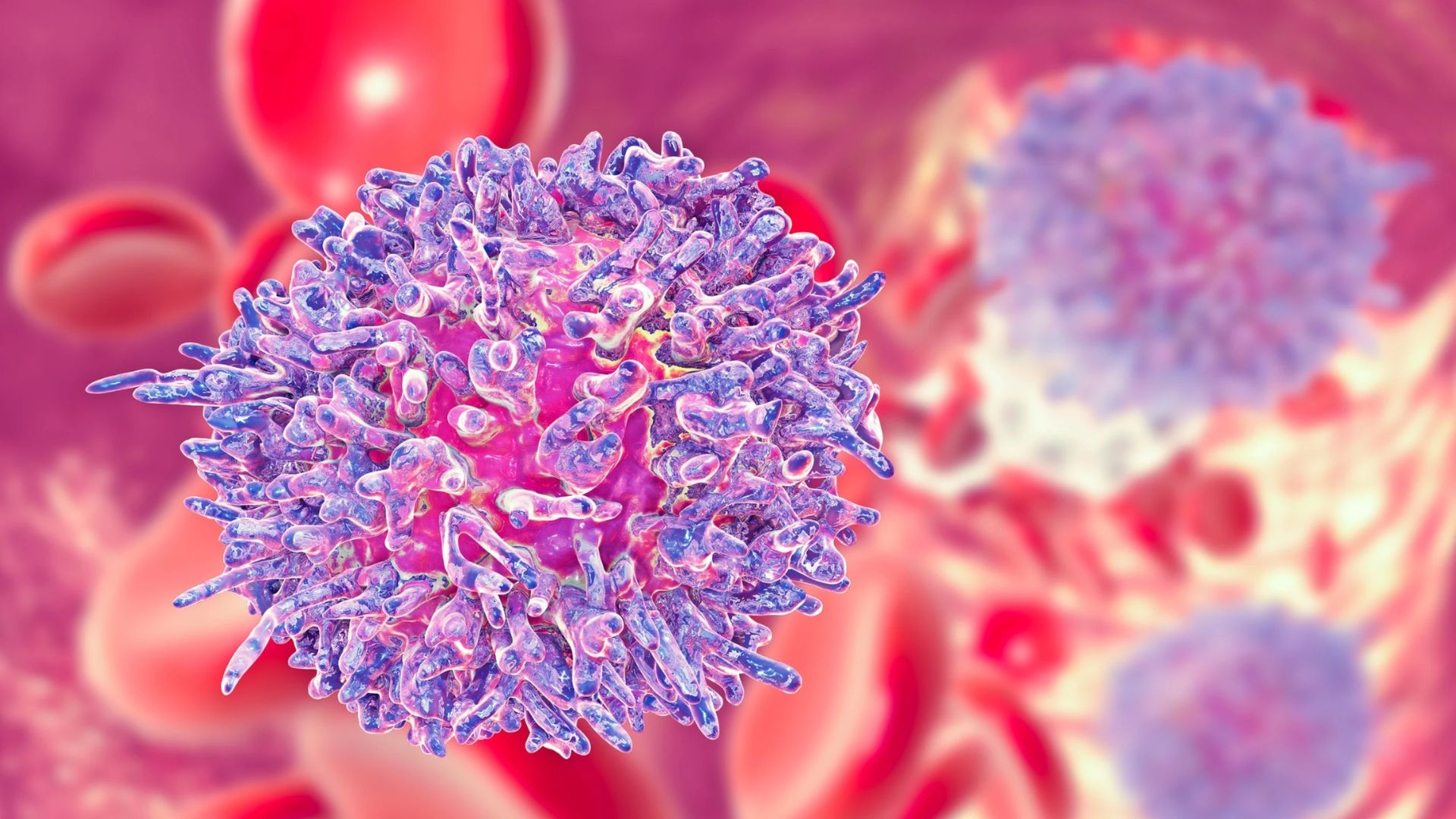 Sốt cao liên tục có thể là dấu hiệu cảnh báo bệnh ung thư máu