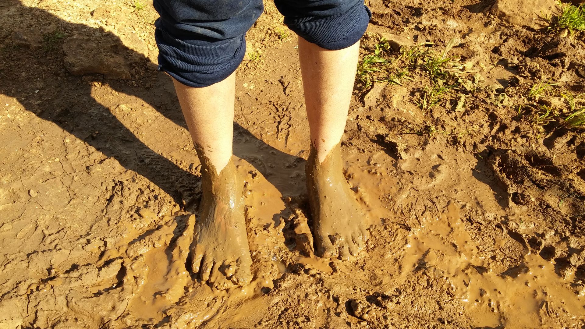 Bệnh sốt đất có tỷ lệ tử vong cao nếu phát hiện muộn