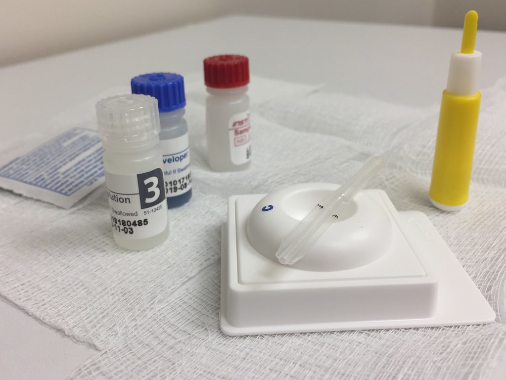 Sốt HIV bao nhiêu độ? Kéo dài bao lâu? 4