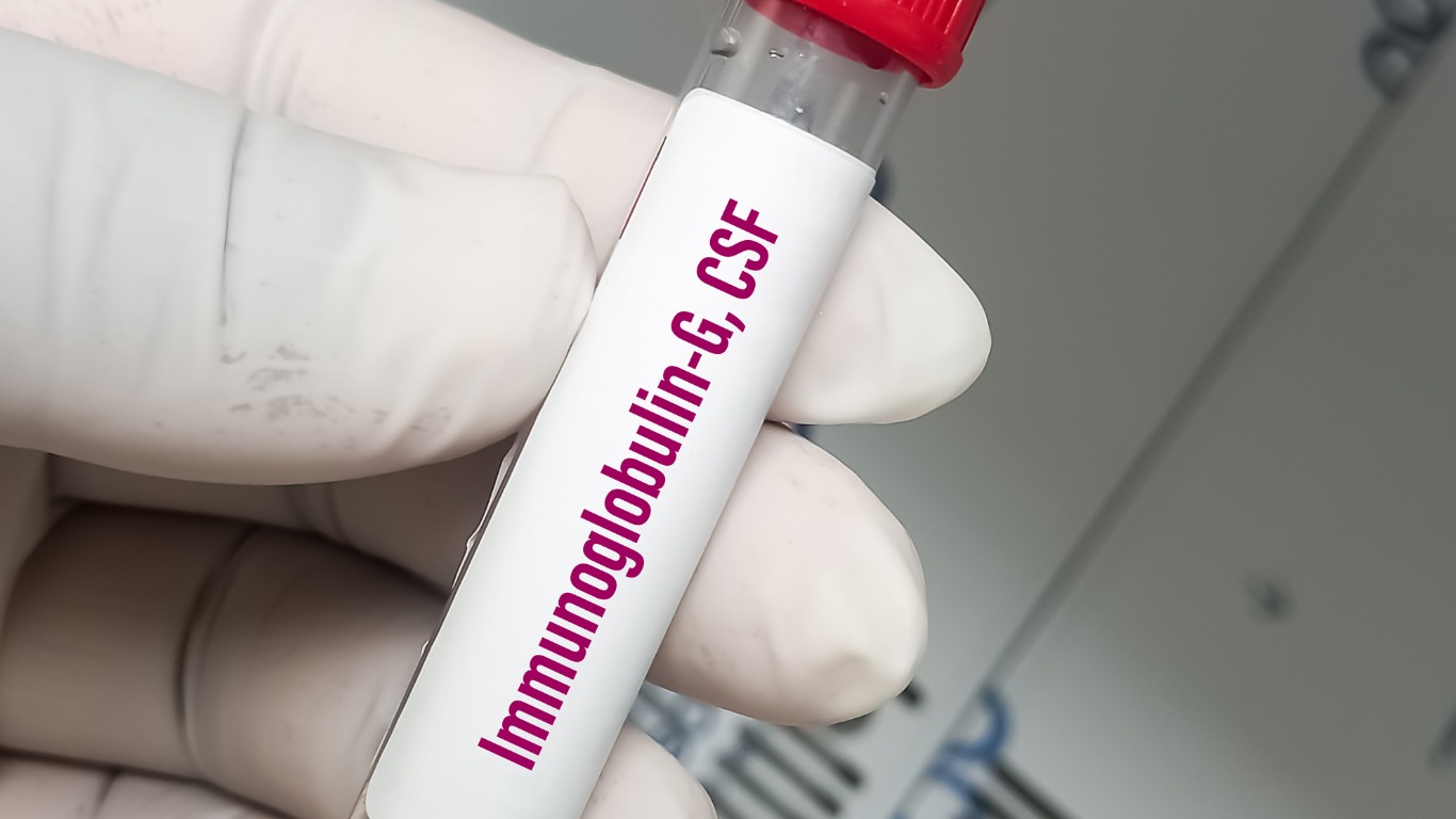 Xét nghiệm IgG giúp xác định tiền sử nhiễm Dengue trước đó