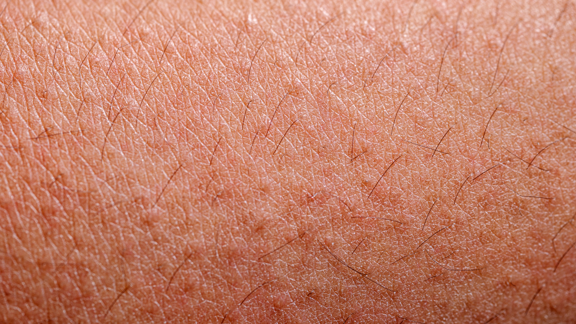 Kiêng gió sai cách có thể khiến người bệnh khó chịu hơn