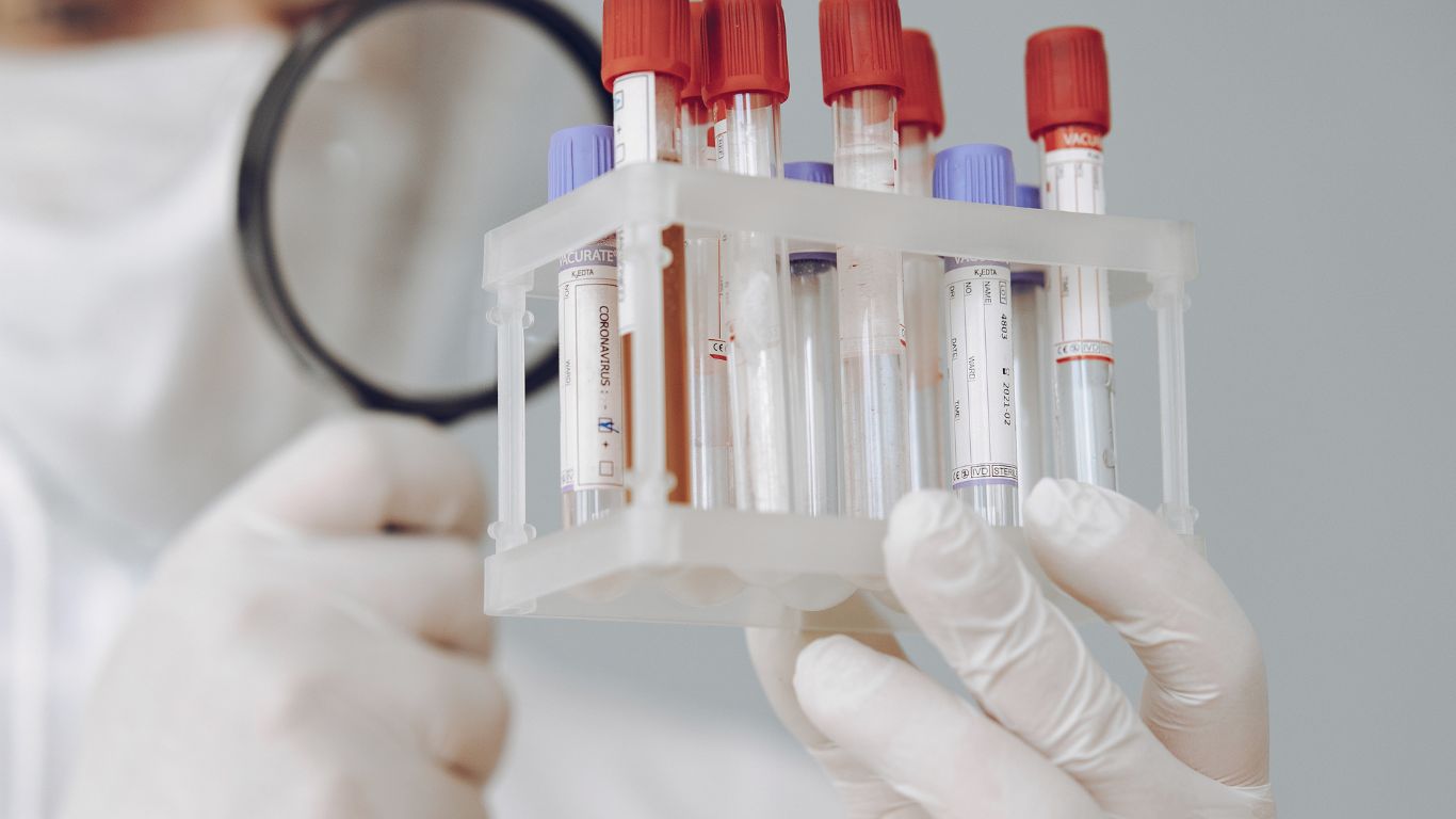 sot-xuat-huyet-khong-phat-ban-co-dang-lo-ngai 2