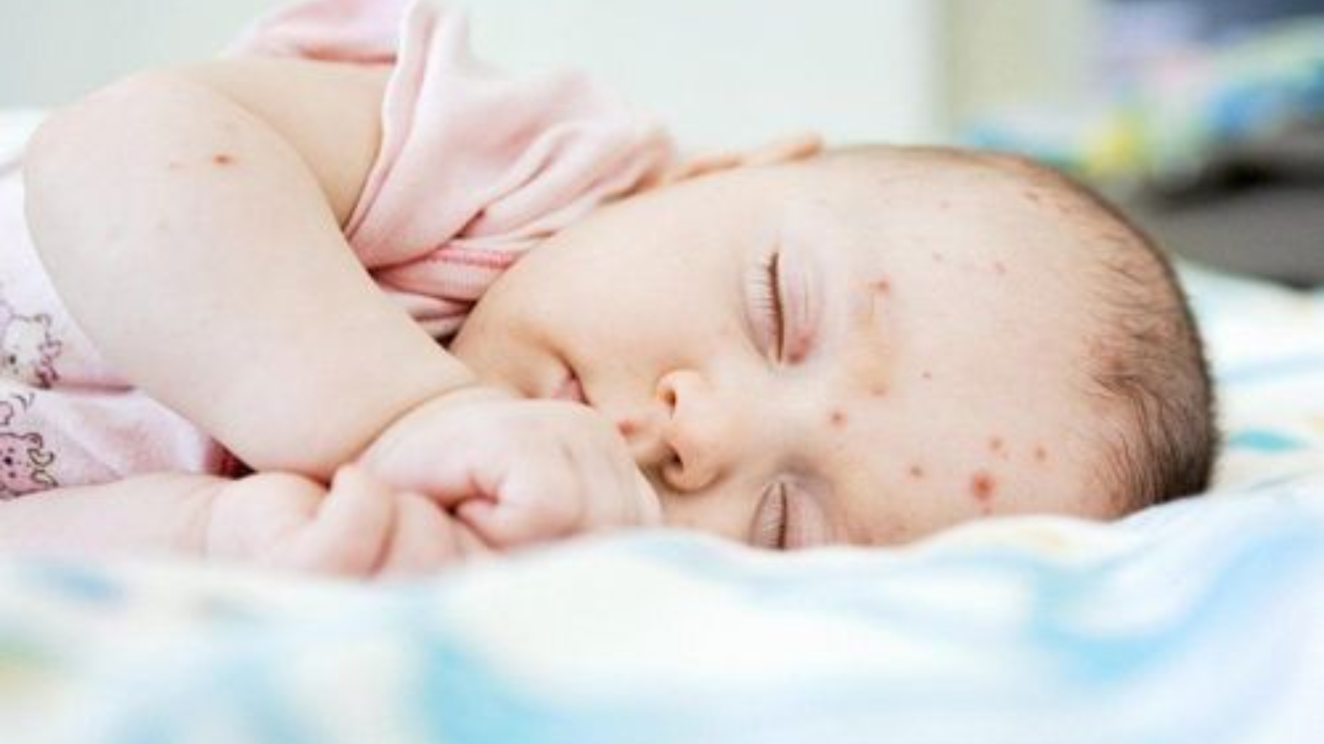 tre-so-sinh-bi-cum-a-co-nguy-hiem-khong-cha-me-khong-nen-chu-quan-3