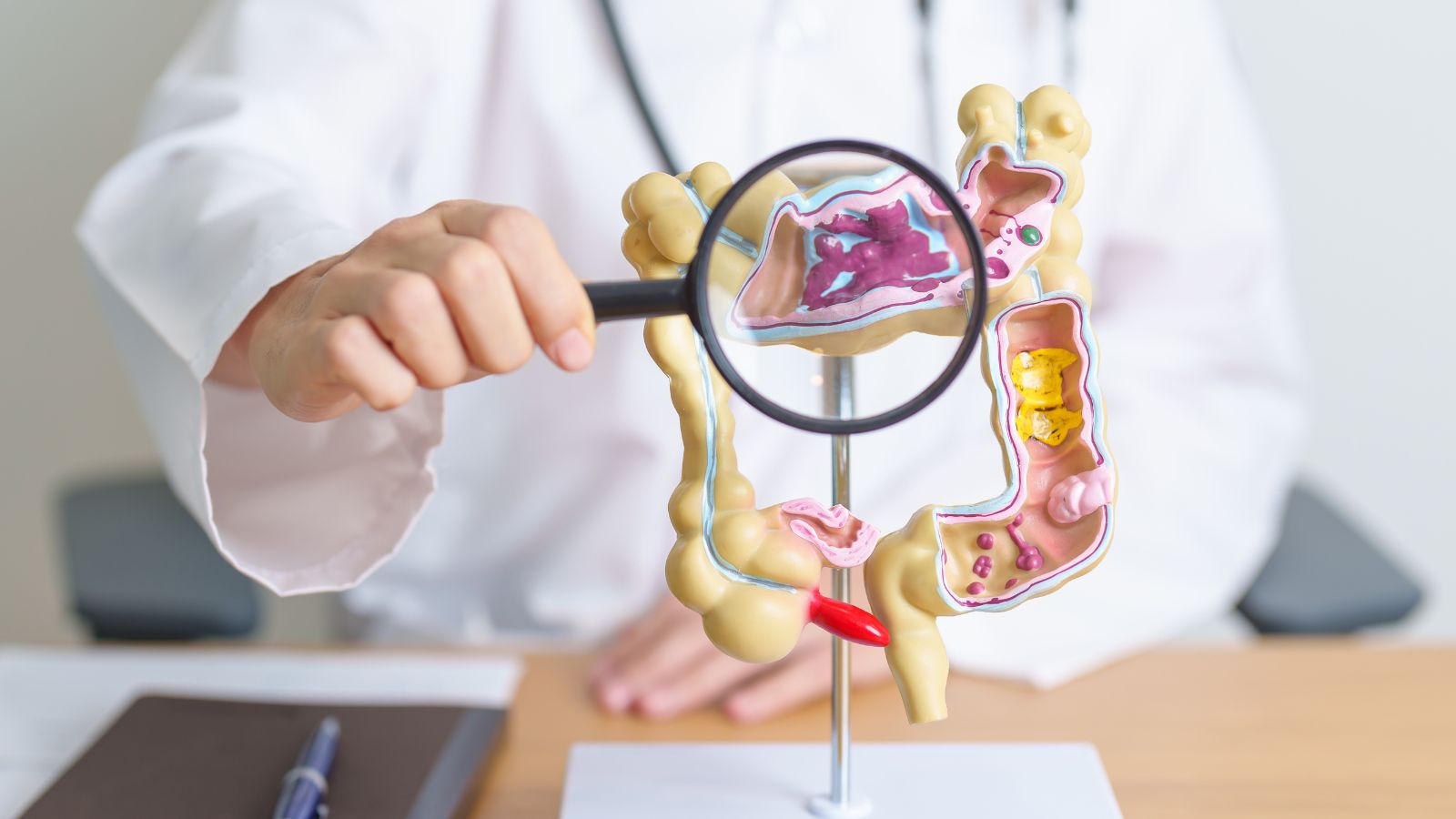 Sự khác nhau giữa viêm đại tràng và đại tràng co thắt 3