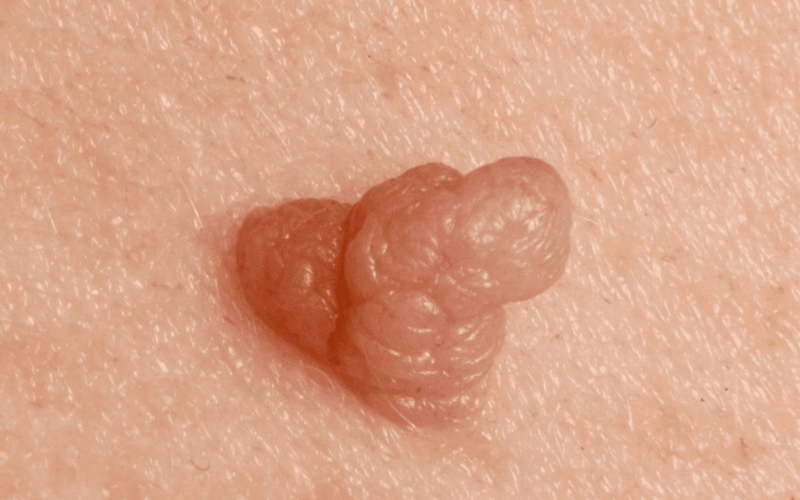 sui-mao-ga-am-dao-benh-ly-dang-lo-ngai-4