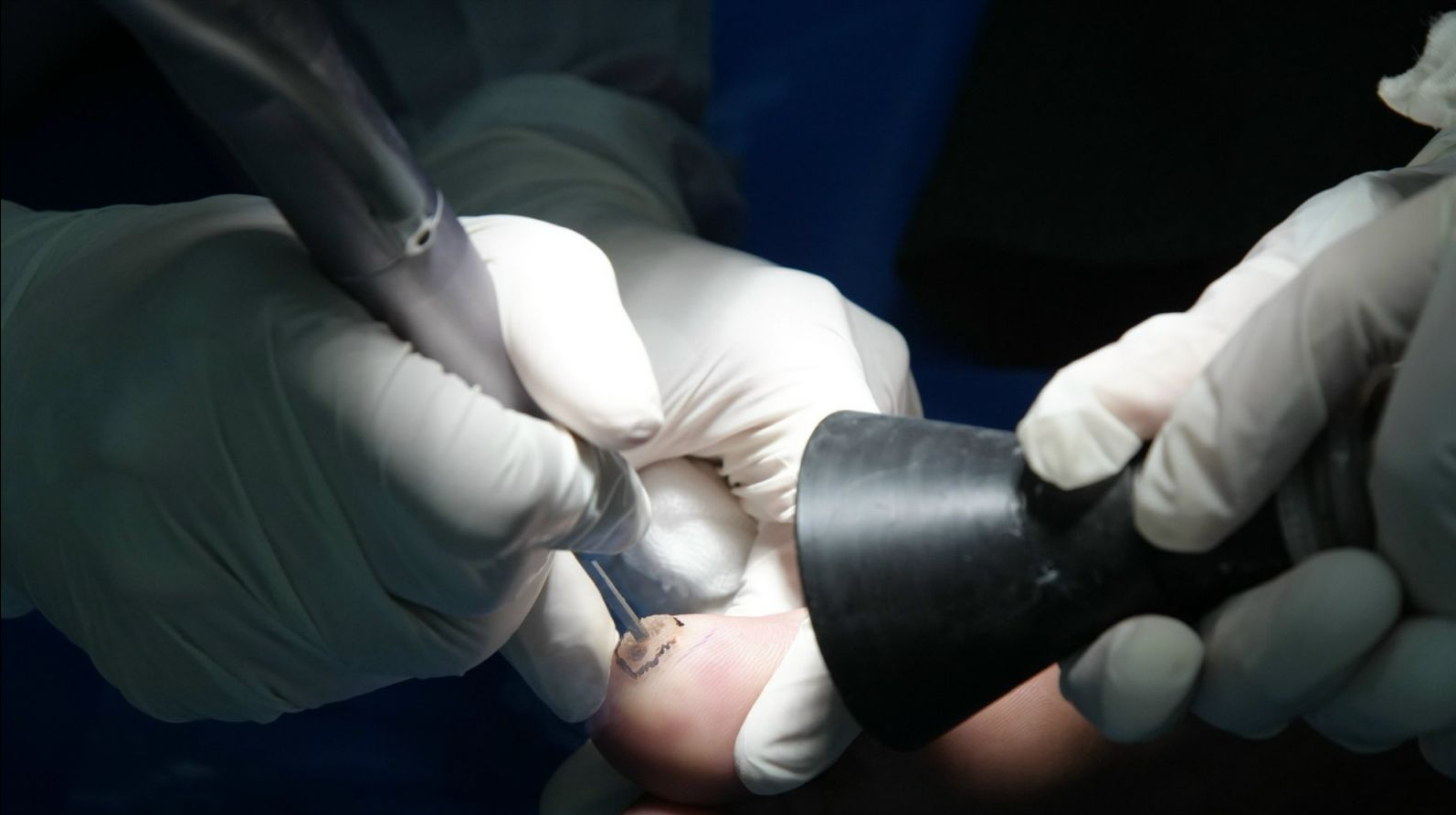 sui-mao-ga-duong-vat-va-nhung-thong-tin-can-biet-1