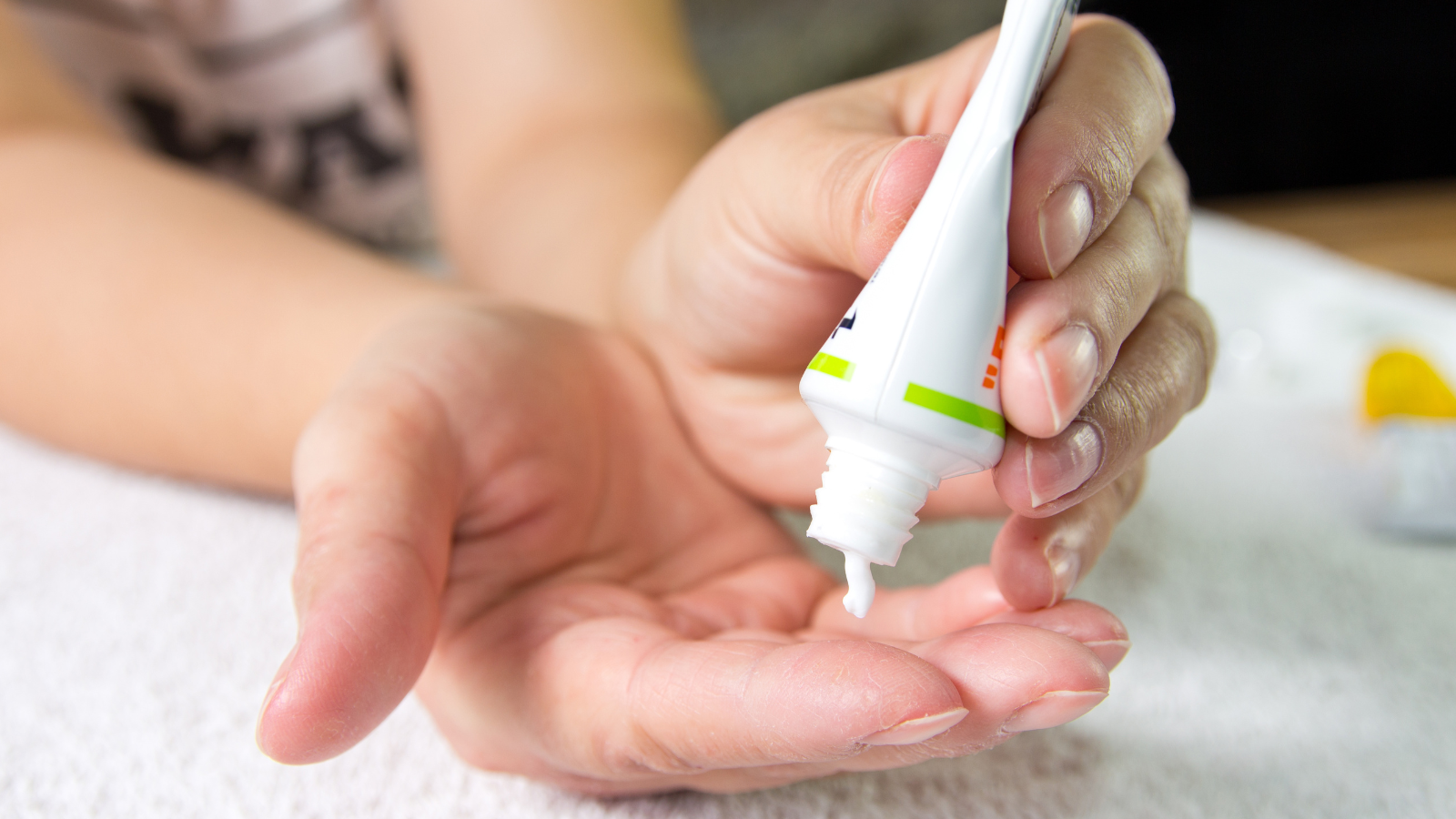 Sử dụng các loại thuốc bôi đặc trị theo toa