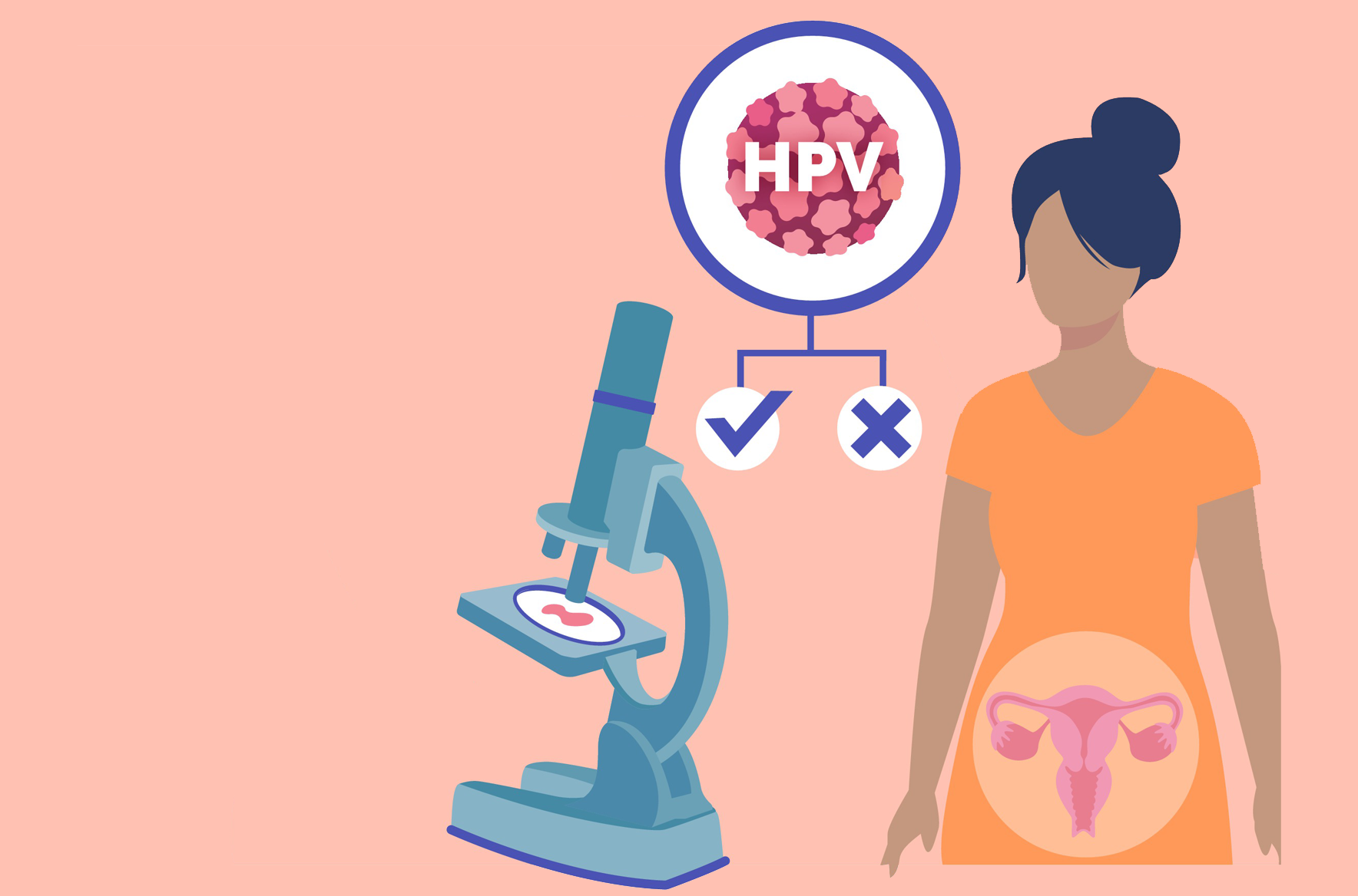 sui-mao-ga-o-nu-va-nhung-dieu-can-biet-5