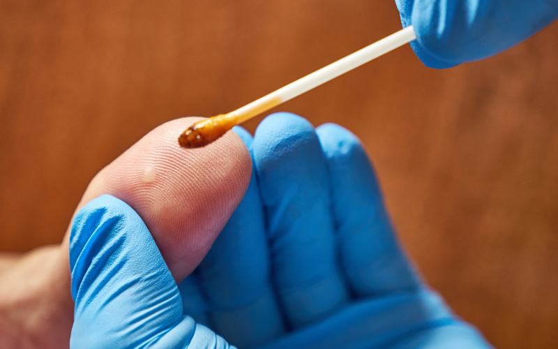 sui-mao-ga-o-tay-co-dang-so-5