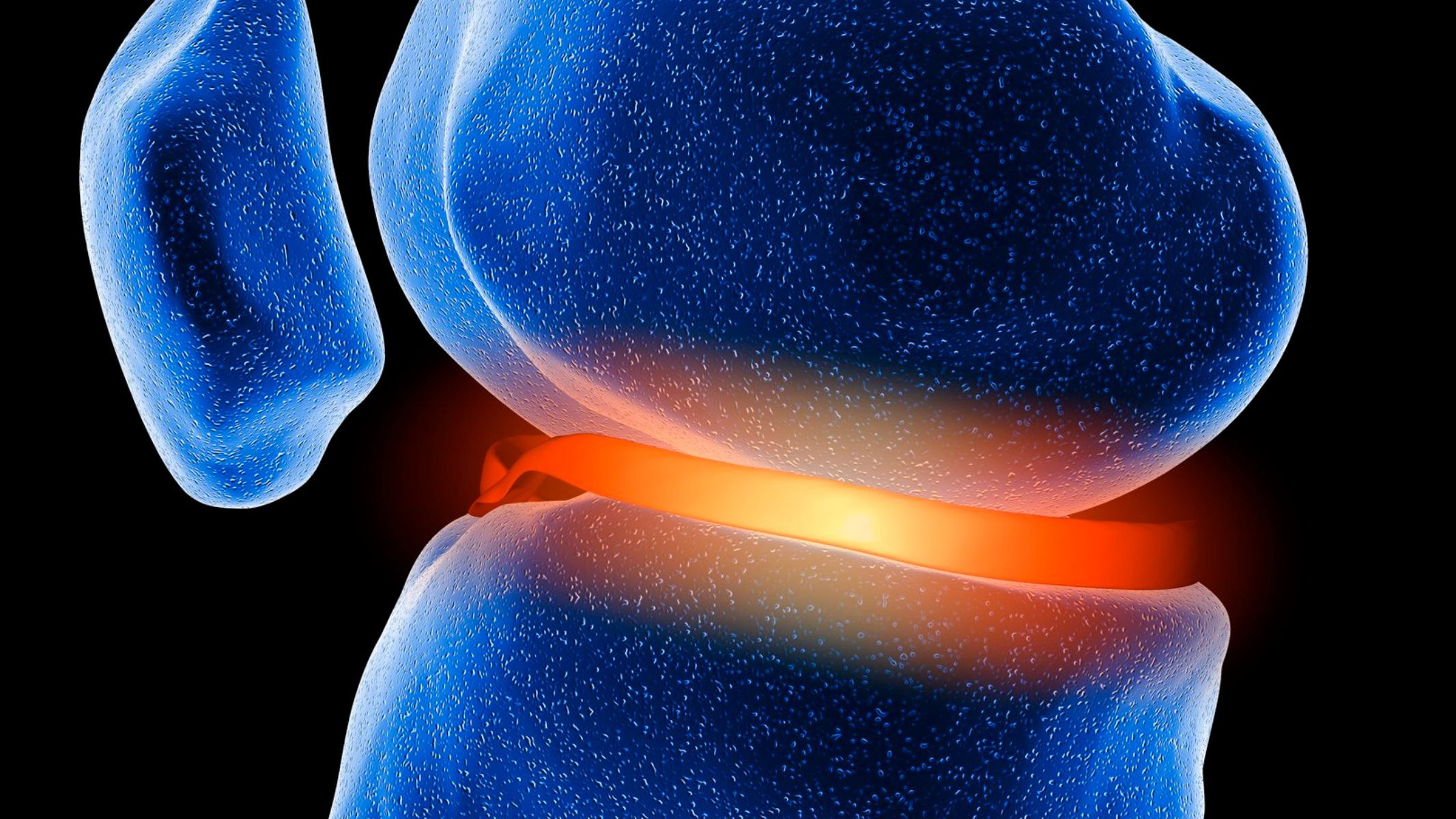 Sụn khớp là mô liên kết đặc biệt bao phủ đầu các xương trong khớp vận động