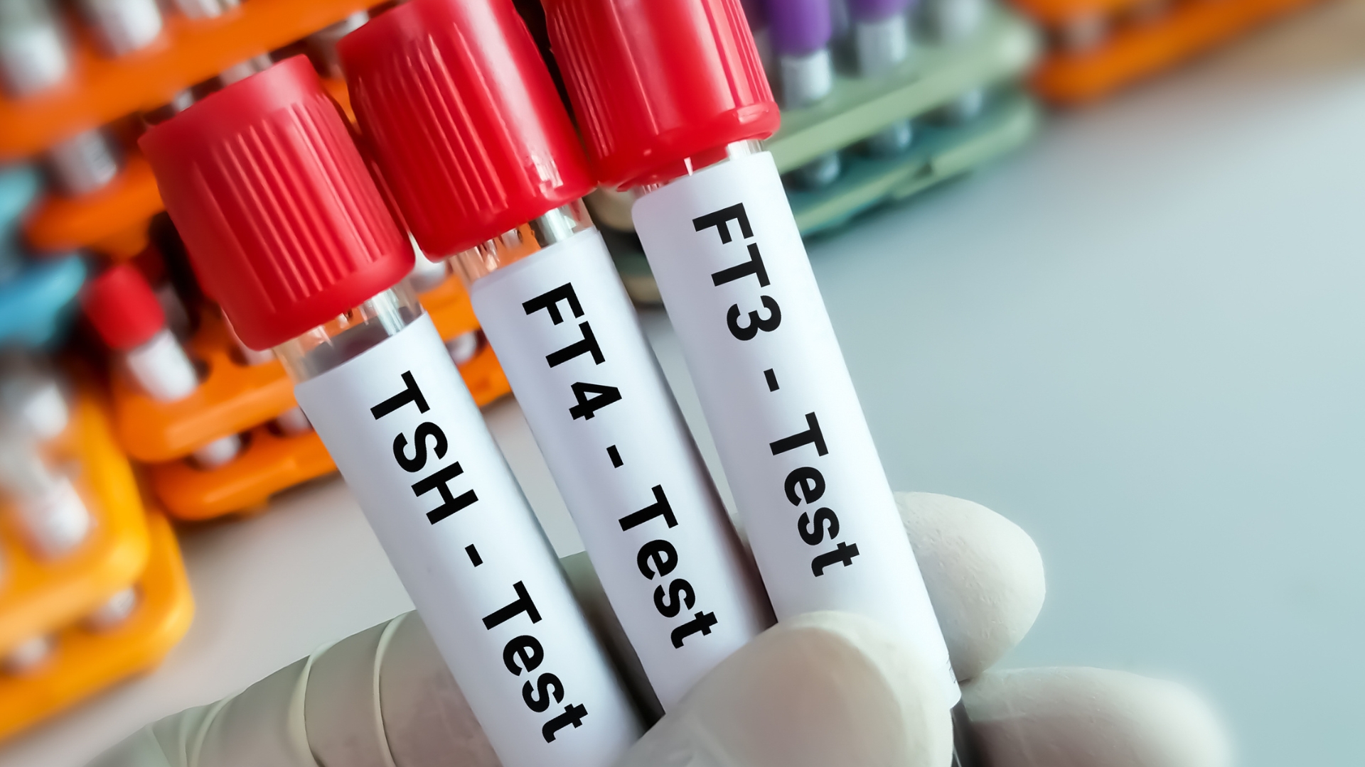 Chẩn đoán suy giáp dưới lâm sàng chủ yếu dựa trên xét nghiệm hormone tuyến giáp và không phụ thuộc vào triệu chứng lâm sàng