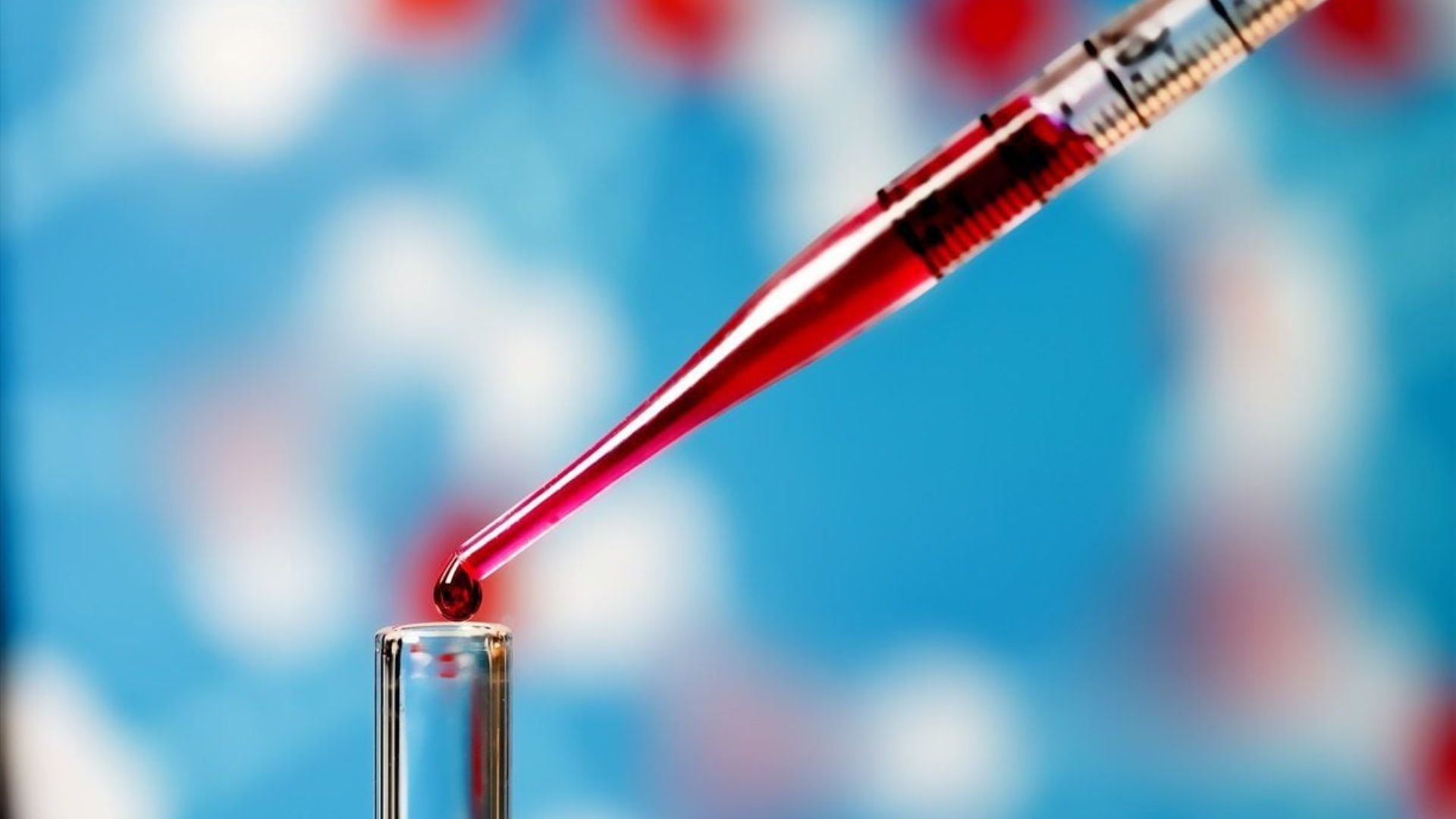 Xét nghiệm máu thường được chỉ định để theo dõi hormone, giúp đánh giá hoạt động hoàng thể và phát hiện bất thường