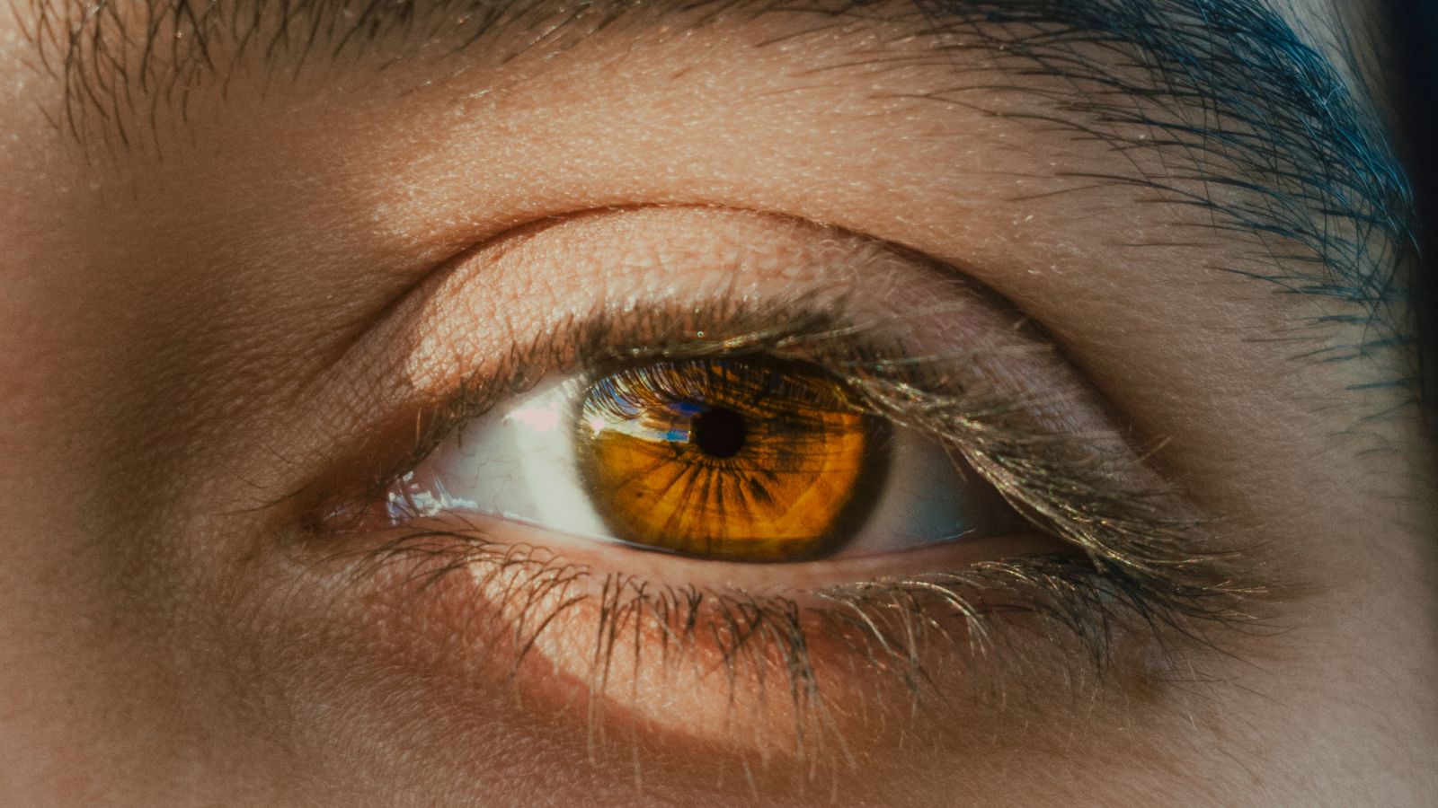 Phần lớn người bệnh phát hiện bất thường sau khi thức dậy, với biểu hiện mất thị lực đột ngột ở một mắt