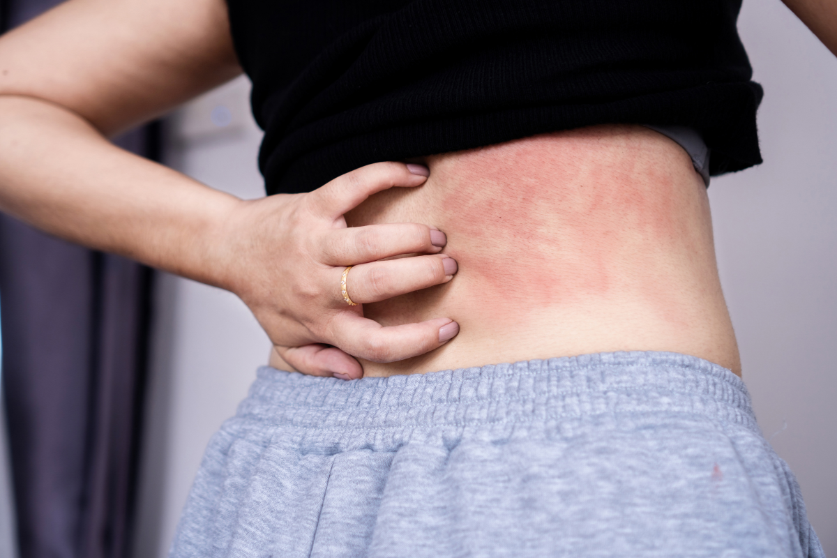 Tác dụng phụ của gây tê ngoài màng cứng sau sinh đối với mẹ bầu là gì? 2