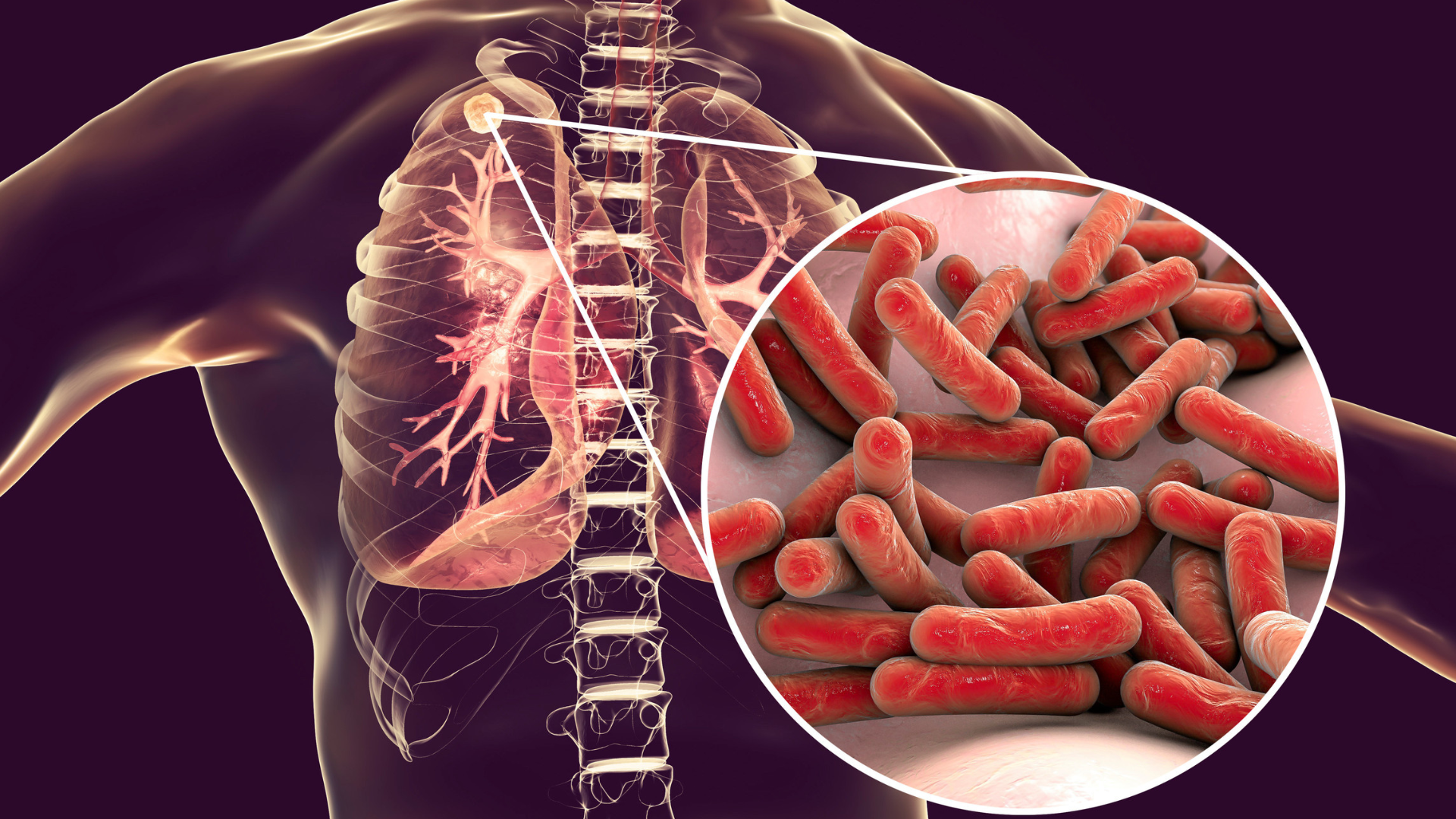 tac-dung-phu-cua-thuoc-lao-tiem-an-la-gi 1.png