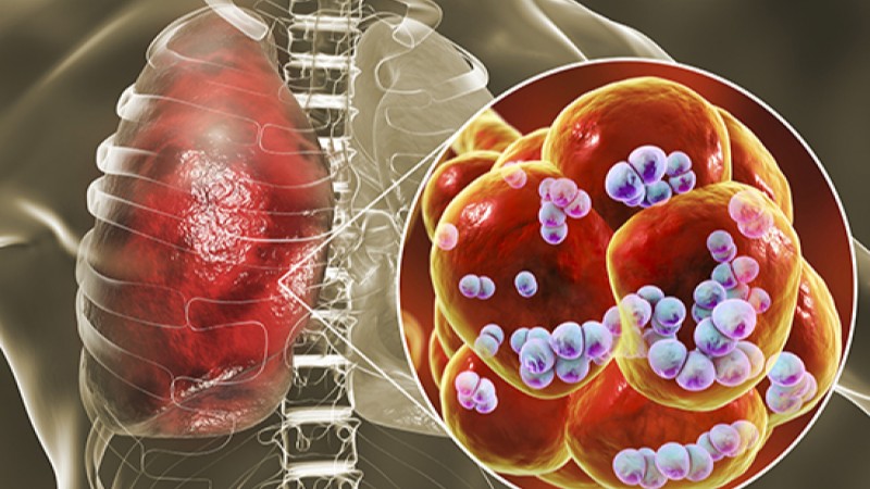 tac-dung-phu-khi-tiem-vac-xin-phe-cau-synflorix-la-gi 1.jpg