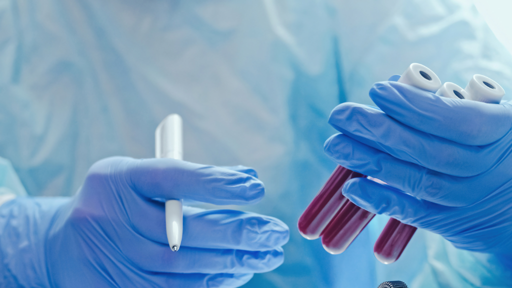 Xét nghiệm công thức máu cho thấy tăng chỉ số ure, creatinin