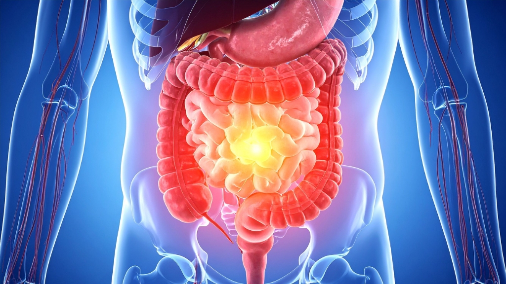 Tắc ruột có phải mổ không? Cách điều trị và những lưu ý quan trọng 1