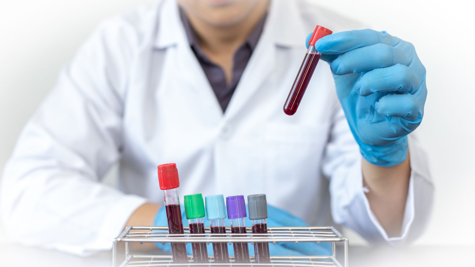 Xét nghiệm máu có thể được chỉ định để theo dõi nồng độ bilirubin