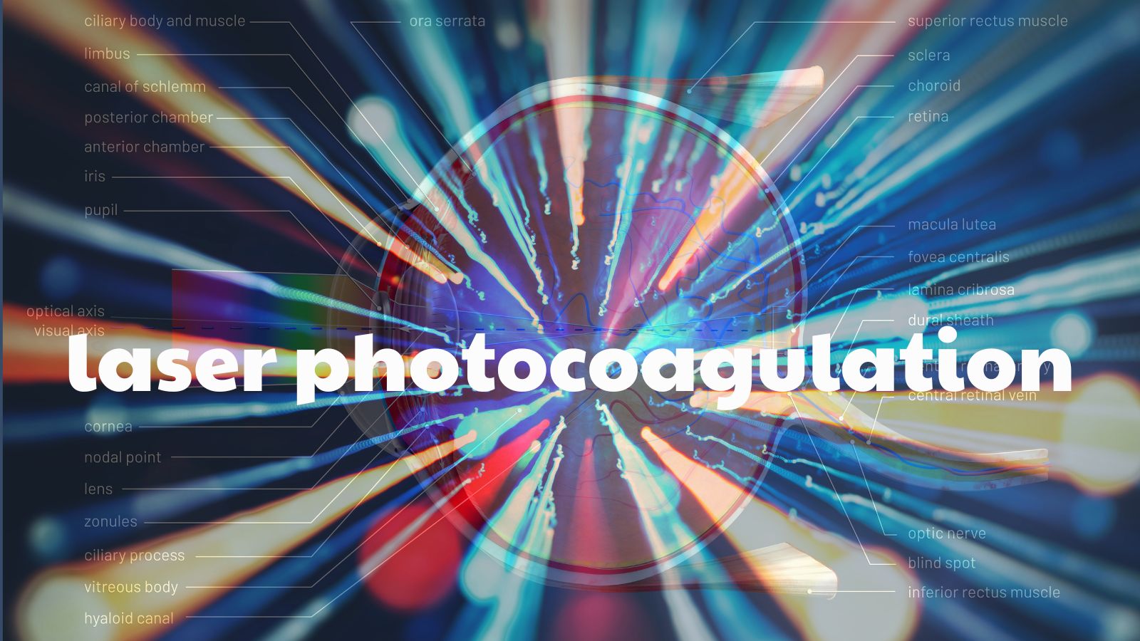 Tia laser sẽ được sử dụng để khóa vùng rách, giúp mô võng mạc dính chắc trở lại