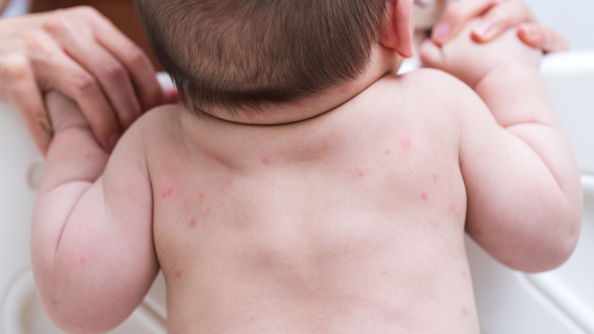 Da trẻ sơ sinh rất nhạy cảm và dễ bị kích ứng nếu chăm sóc không đúng cách