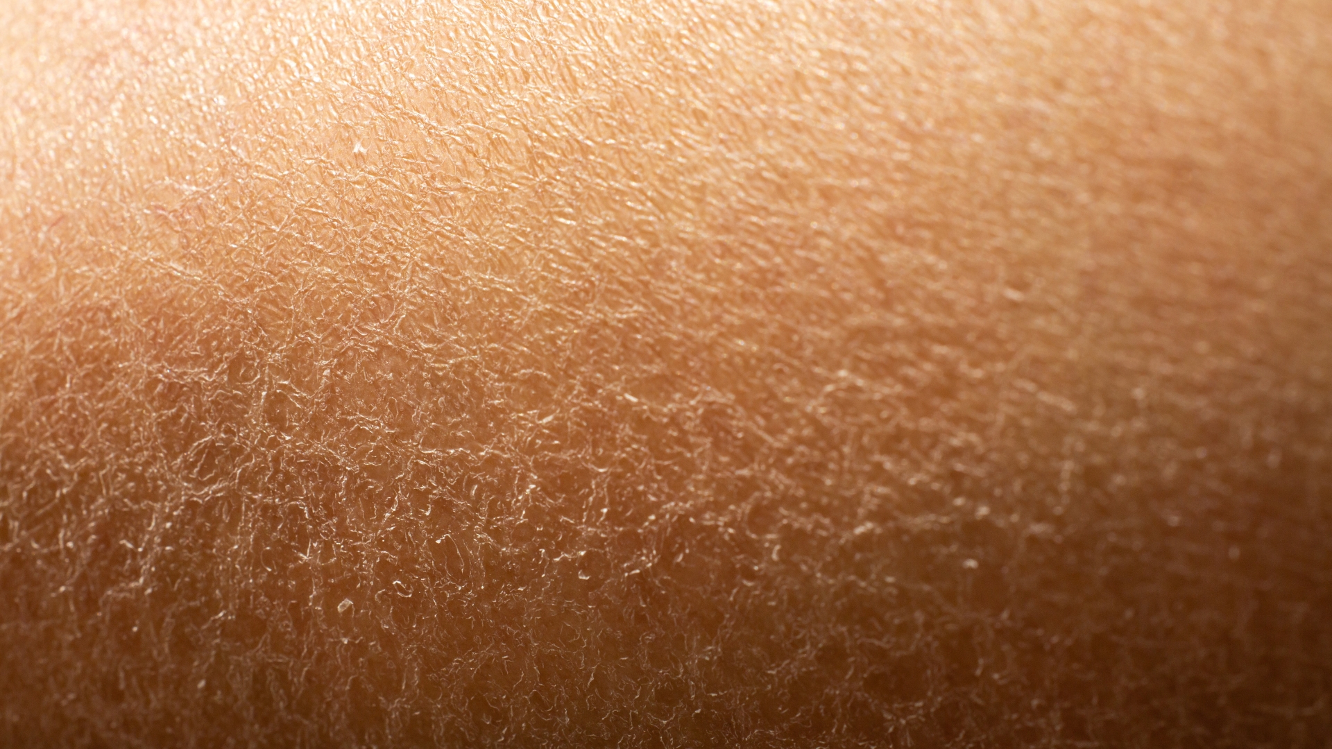 Nhiệt độ quá cao của nước hay ngâm nước qua lâu lại dây tác dụng ngược khiến làn da trở nên khô và mất độ ẩm tự nhiên