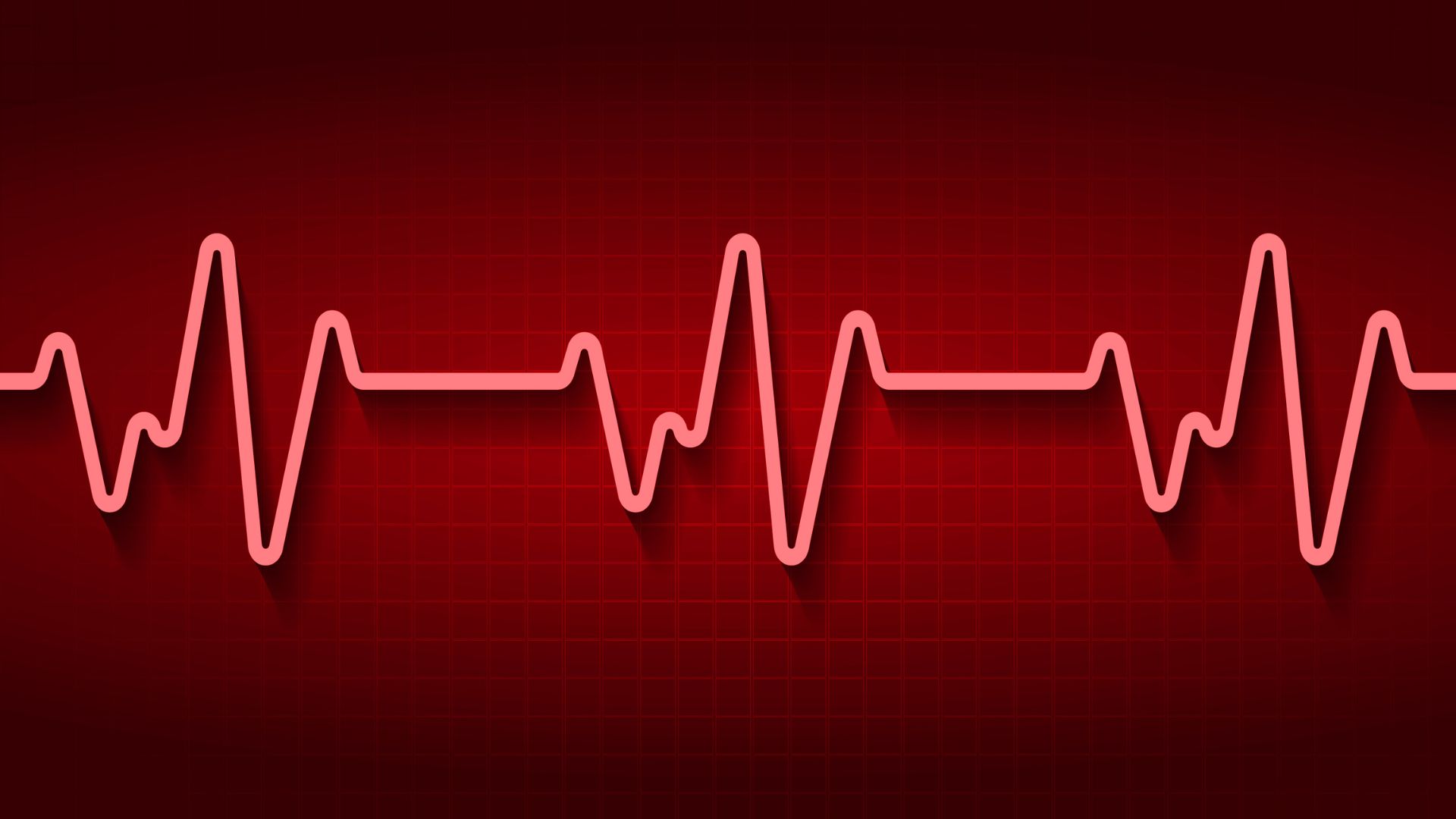 Nhịp tim thay đổi là một triệu chứng của tình trạng kali trong máu tăng