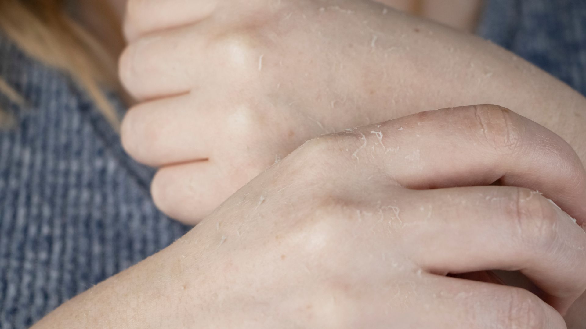 Bạn nên đến gặp bác sĩ nếu tay bị bong tróc da kèm theo thay đổi màu