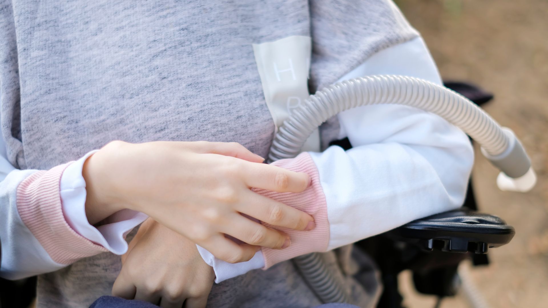 Tê bì chân tay có thể dẫn đến teo cơ nếu không được điều trị kịp thời