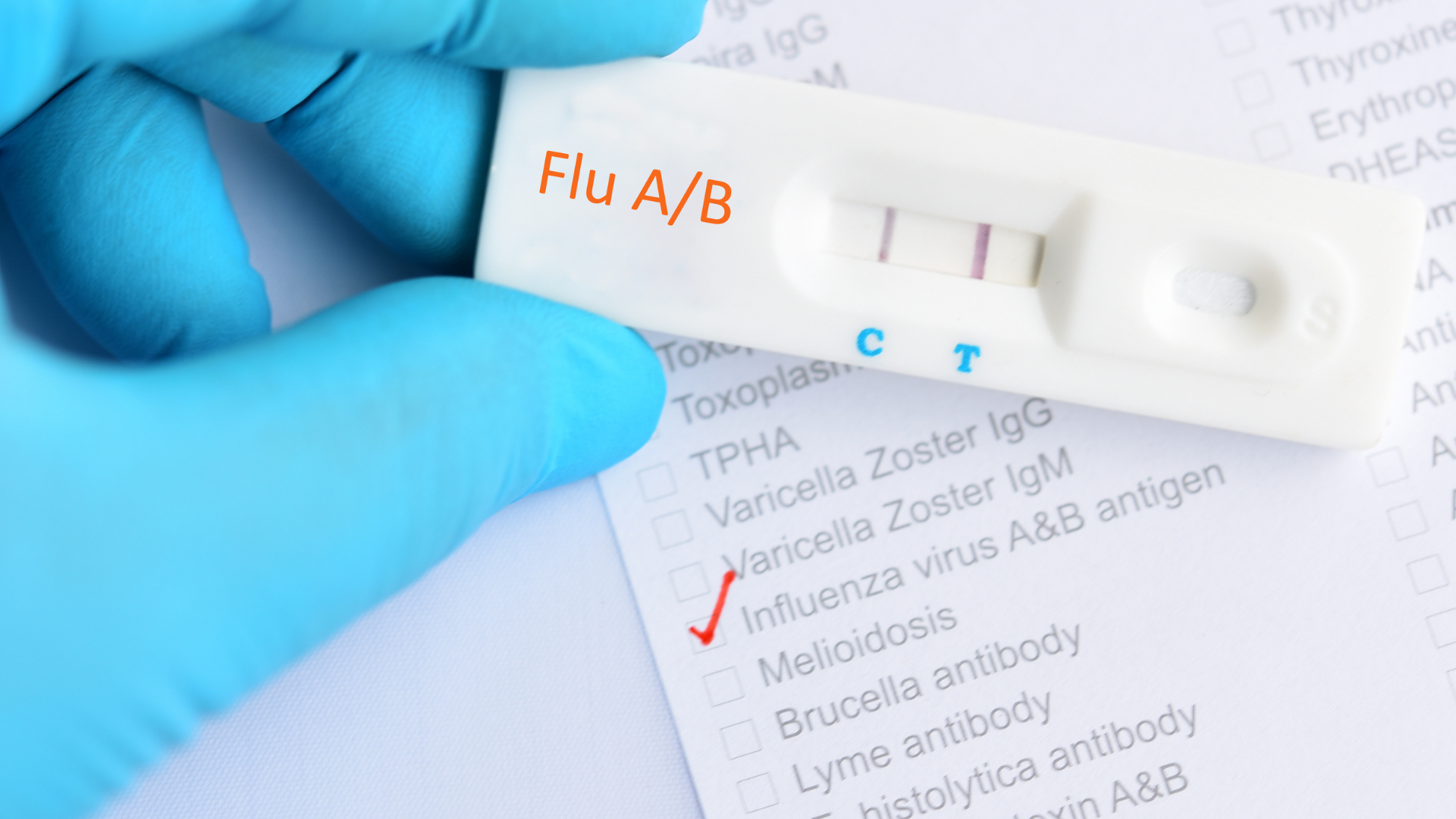 test-cum-a-vao-thoi-diem-nao-va-co-nhung-phuong-phap-xet-nghiem-nao 4.png