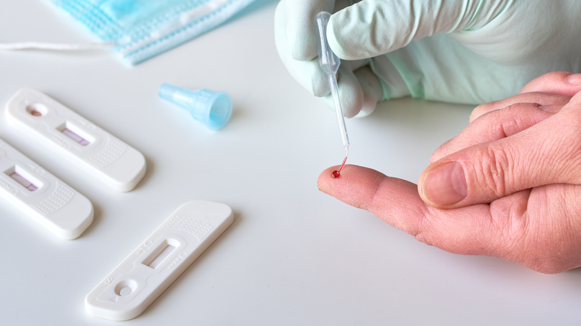 Xét nghiệm kháng thể được thực hiện bằng các kỹ thuật phân tích mẫu máu trong phòng thí nghiệm