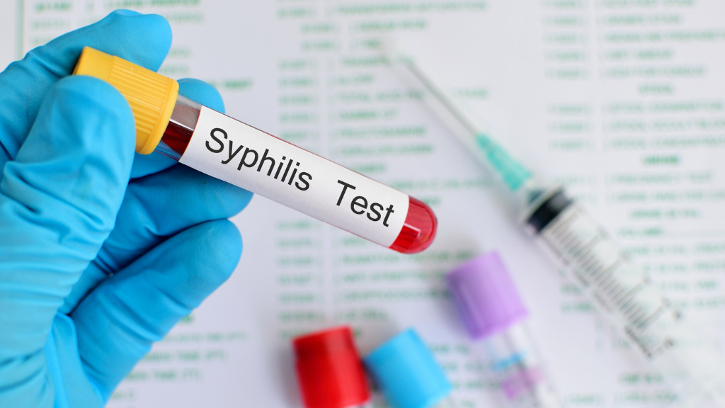 Test nhanh giang mai là phương pháp sàng lọc giúp phát hiện sự có mặt của kháng thể giang mai trong máu