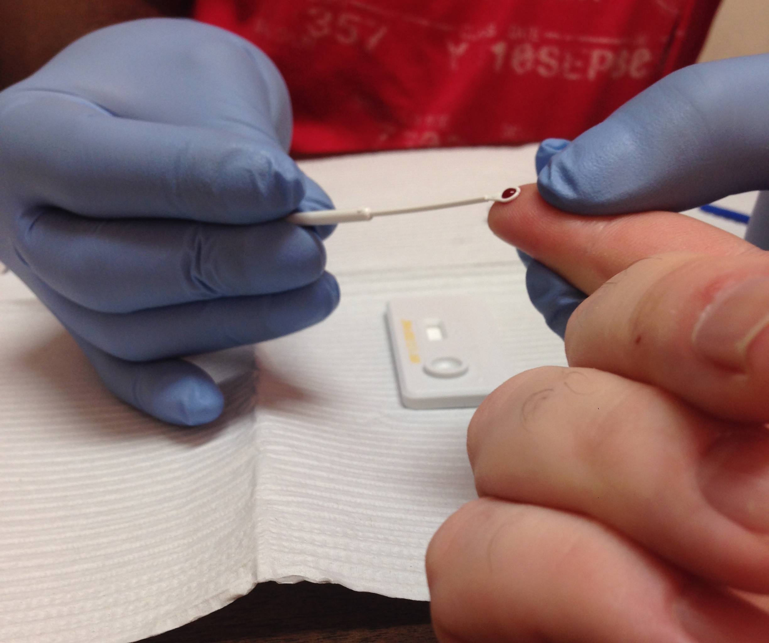 Test nhanh HIV sau bao lâu chính xác nhất? 1