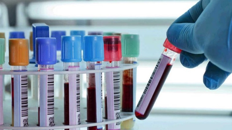 Test nhanh viêm gan C có thời gian có kết quả nhanh