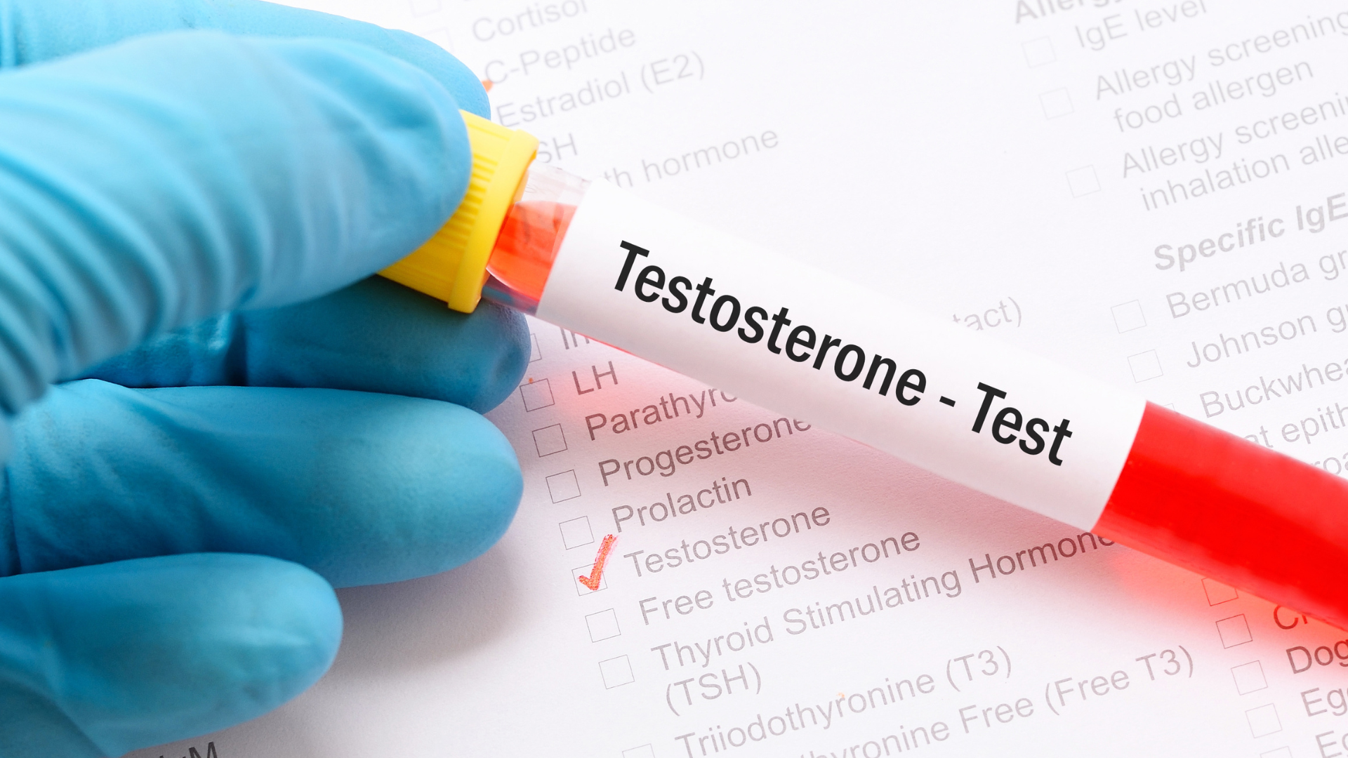 Testosterone có vai trò gì với nam giới? Hiểu đúng để bảo vệ sức khỏe toàn diện 4