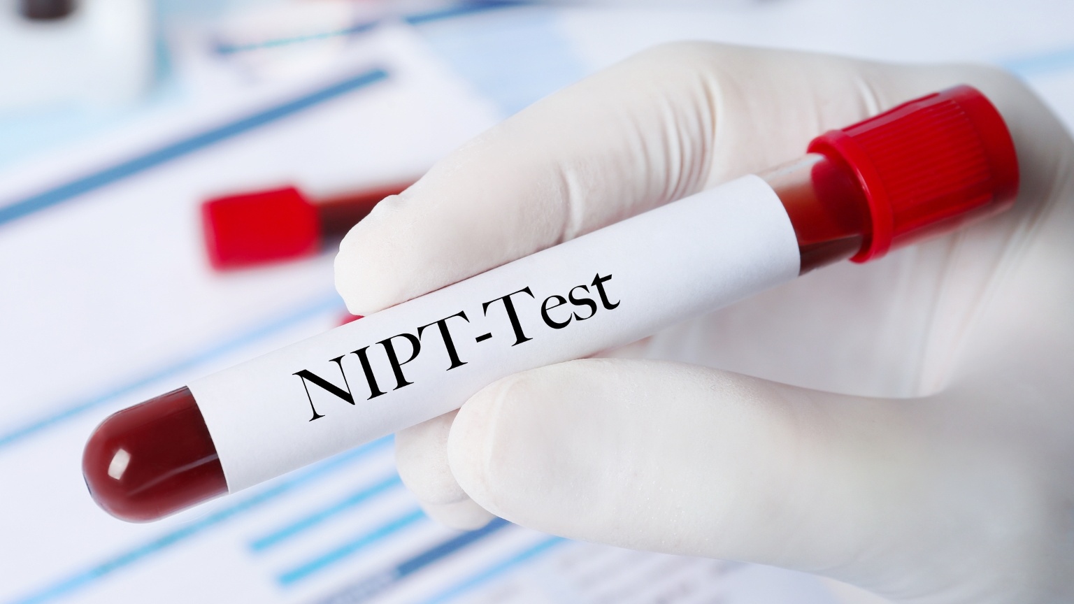 Xét nghiệm NIPT ở thai 13 tuần giúp phát hiện sớm các bất thường nhiễm sắc thể