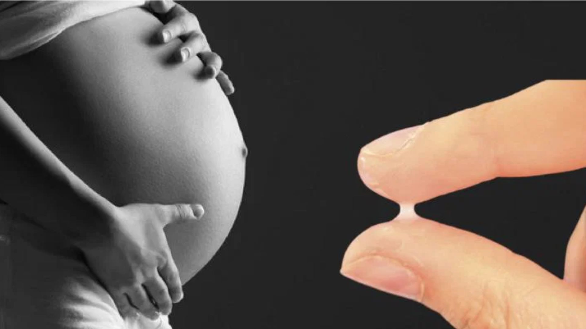 Ra dịch nhầy màu trắng đục ở tuần thai thứ 37 có thể do tăng tiết dịch âm đạo sinh lý