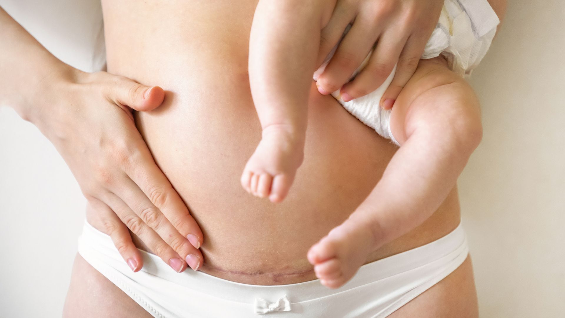 Khoảng cách giữa 2 lần mang thai quá gần làm tăng nguy cơ thai bám vào vết mổ cũ