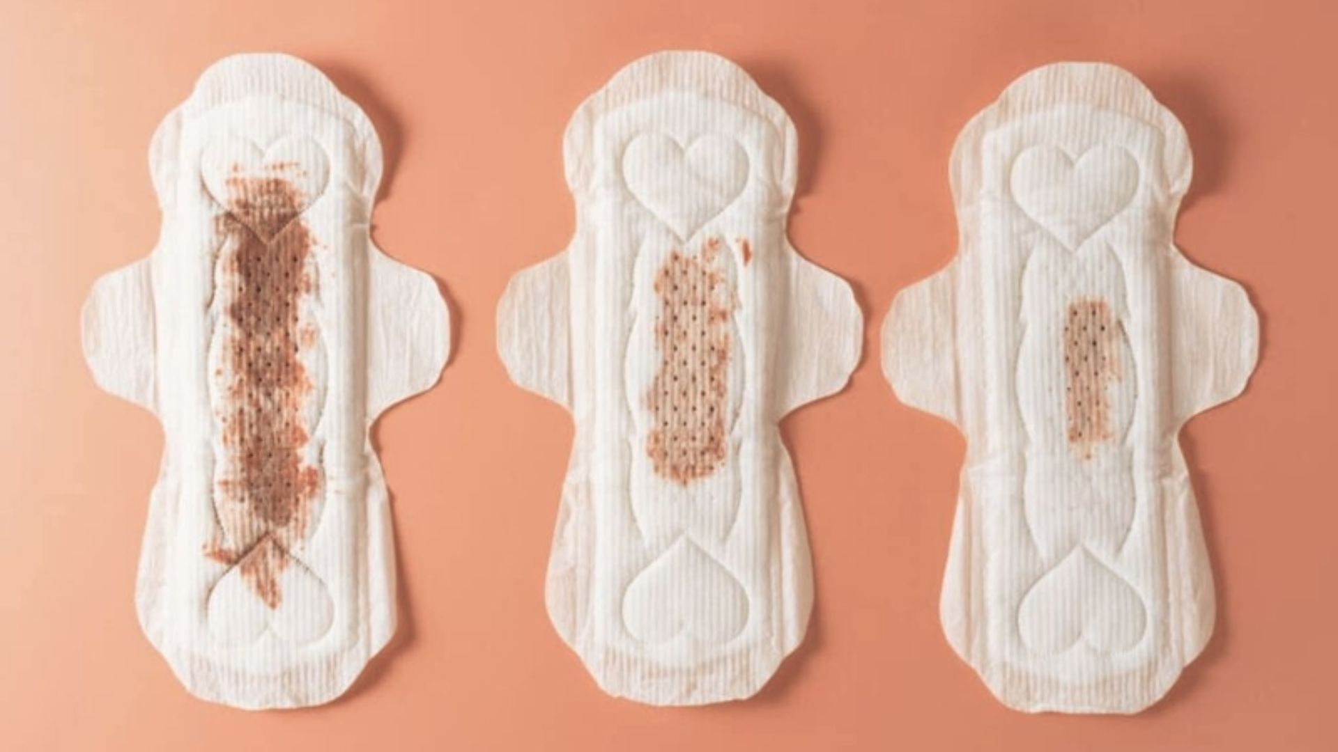 Thai IVF bị ra dịch nâu thường không nguy hiểm nếu không kèm dấu hiệu bất thường