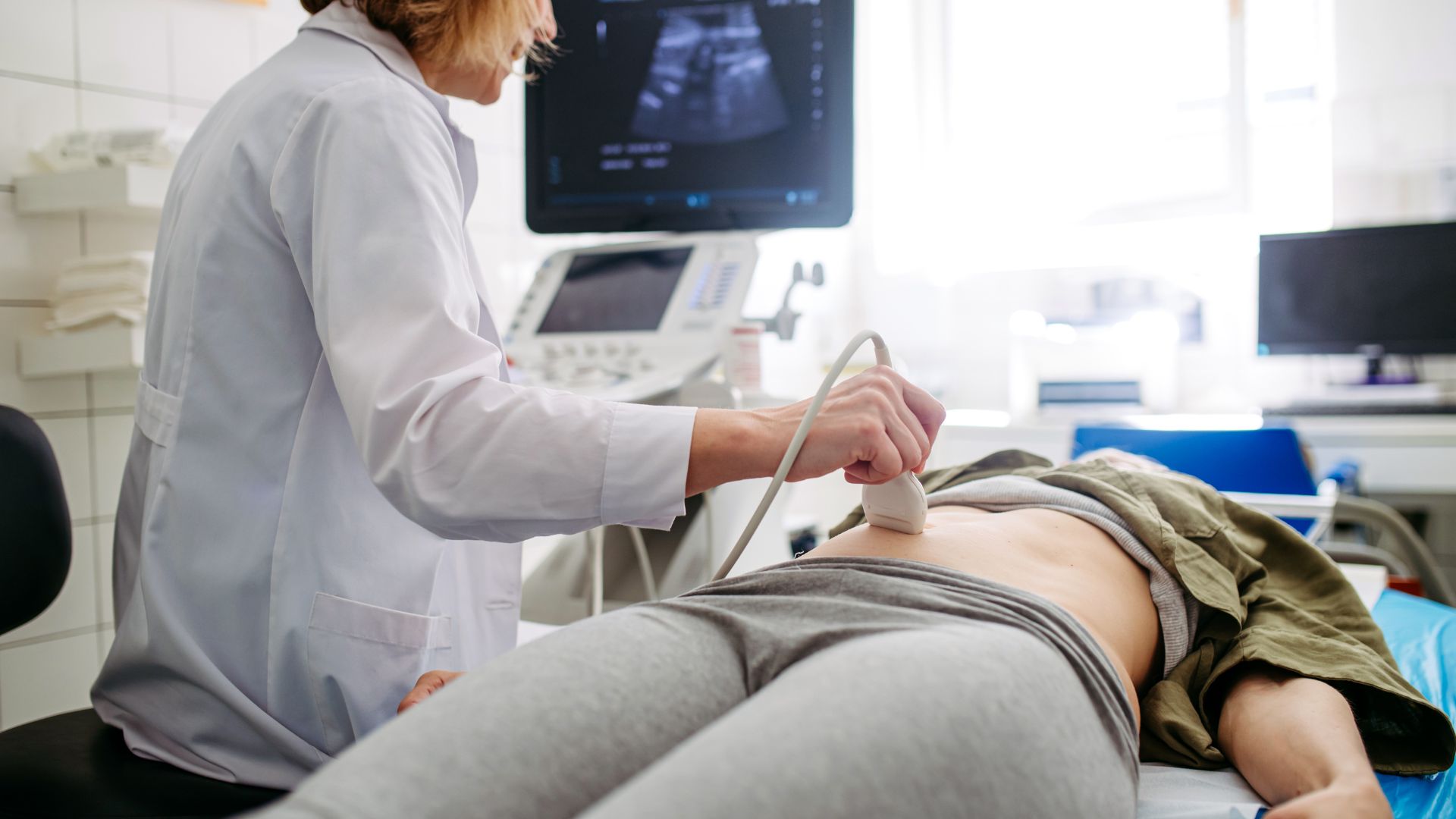 Thận ứ nước trên siêu âm là tình trạng giãn bể thận hoặc đài thận khi siêu âm